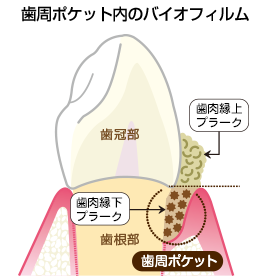 バイオフィルム