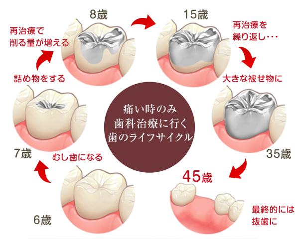 予防のサイクル