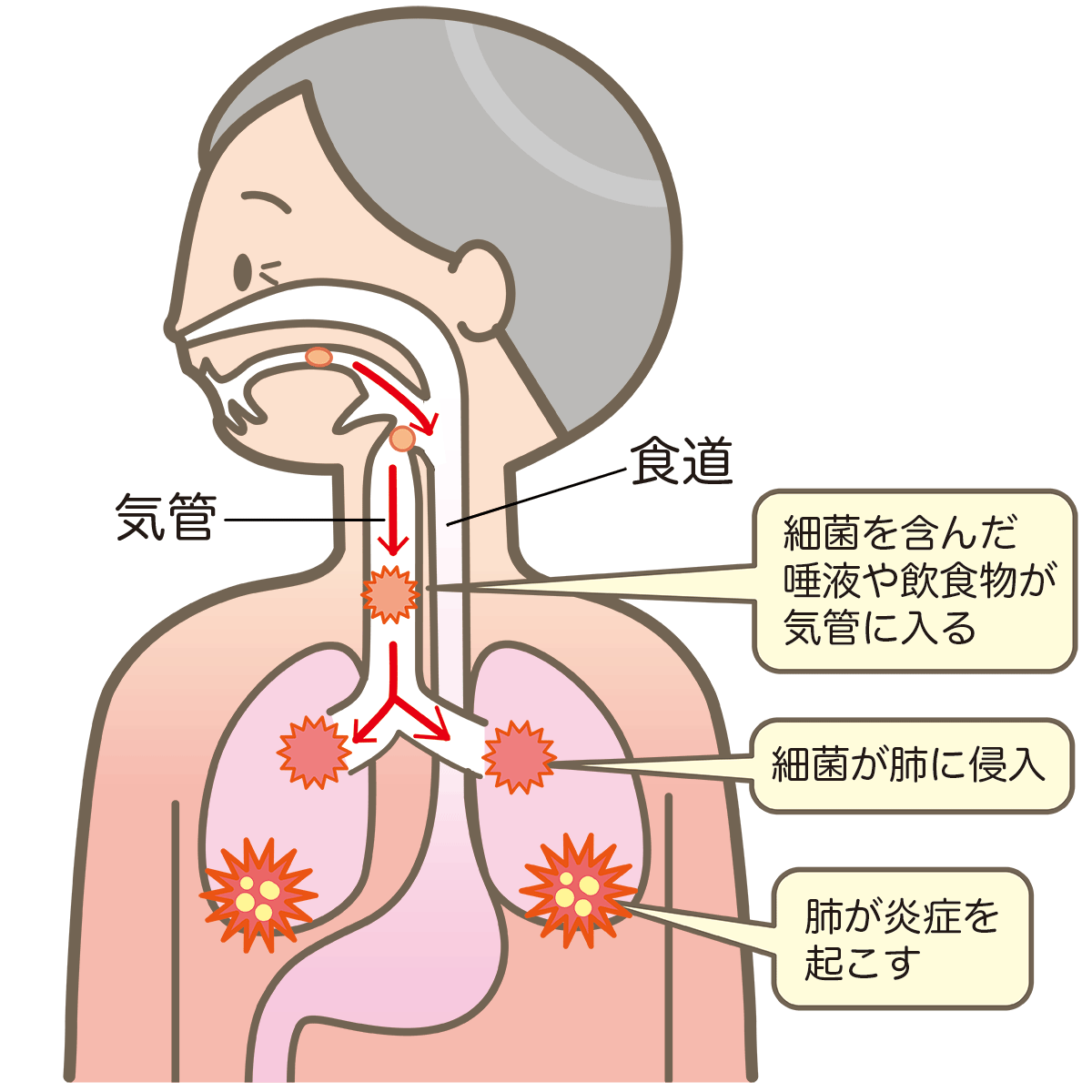 口腔 細菌